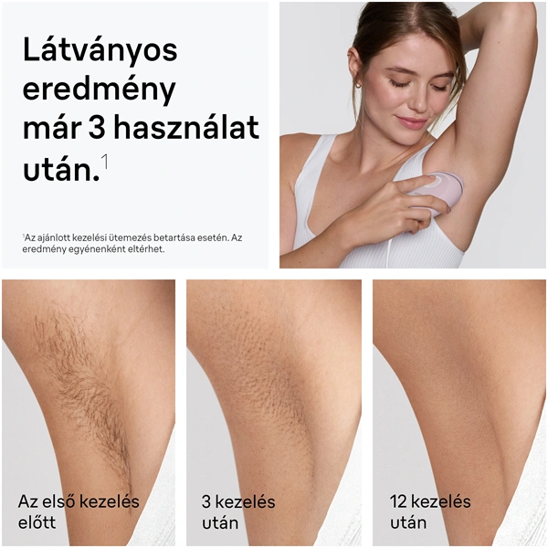 BRAUN Silk-Expert IPL PL1100 villanófényes szőrtelenítő