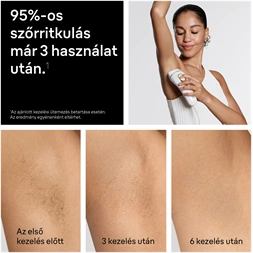 BRAUN Silk-Expert IPL PL5210 villanófényes szőrtelenítő