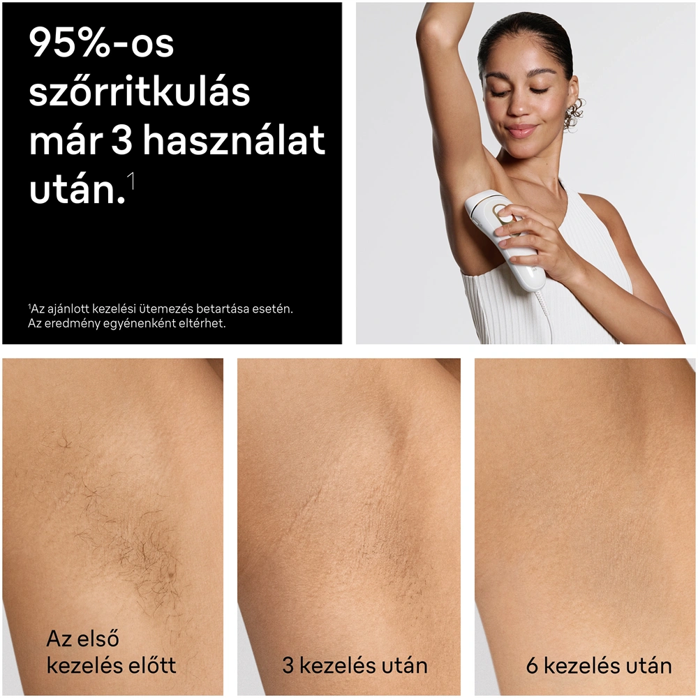 BRAUN Silk-Expert IPL PL5351 villanófényes szőrtelenítő