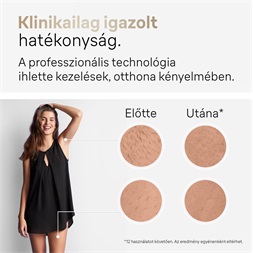 Braun Silk-expert Pro 5 PL5382 IPL villanófényes szőrtelenítő